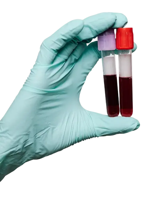 Lab Tests & Diagnostics